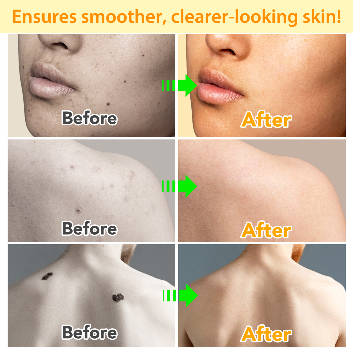 SPRAY ANTIVERRUGAS - TAG RECEDE